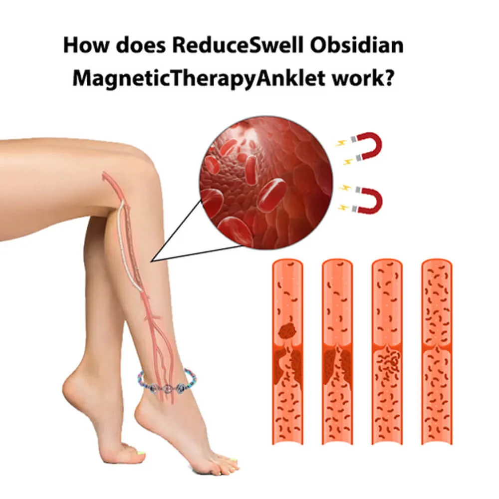 Magnetic Anklet For Swelling
